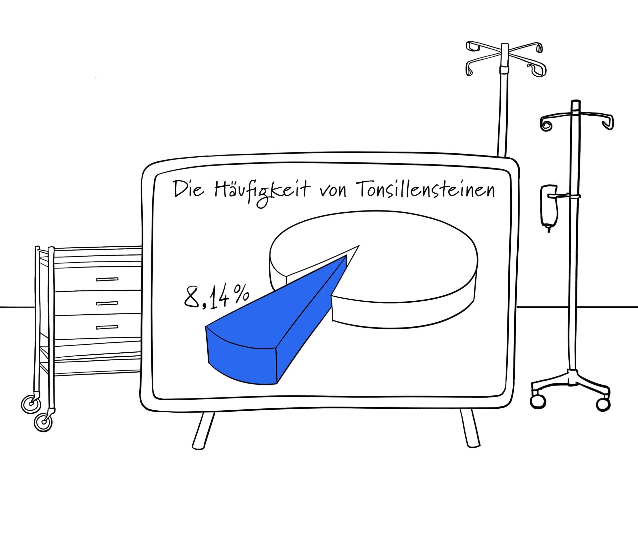 Grafik Untersuchte Patienten mit Mandelsteinen