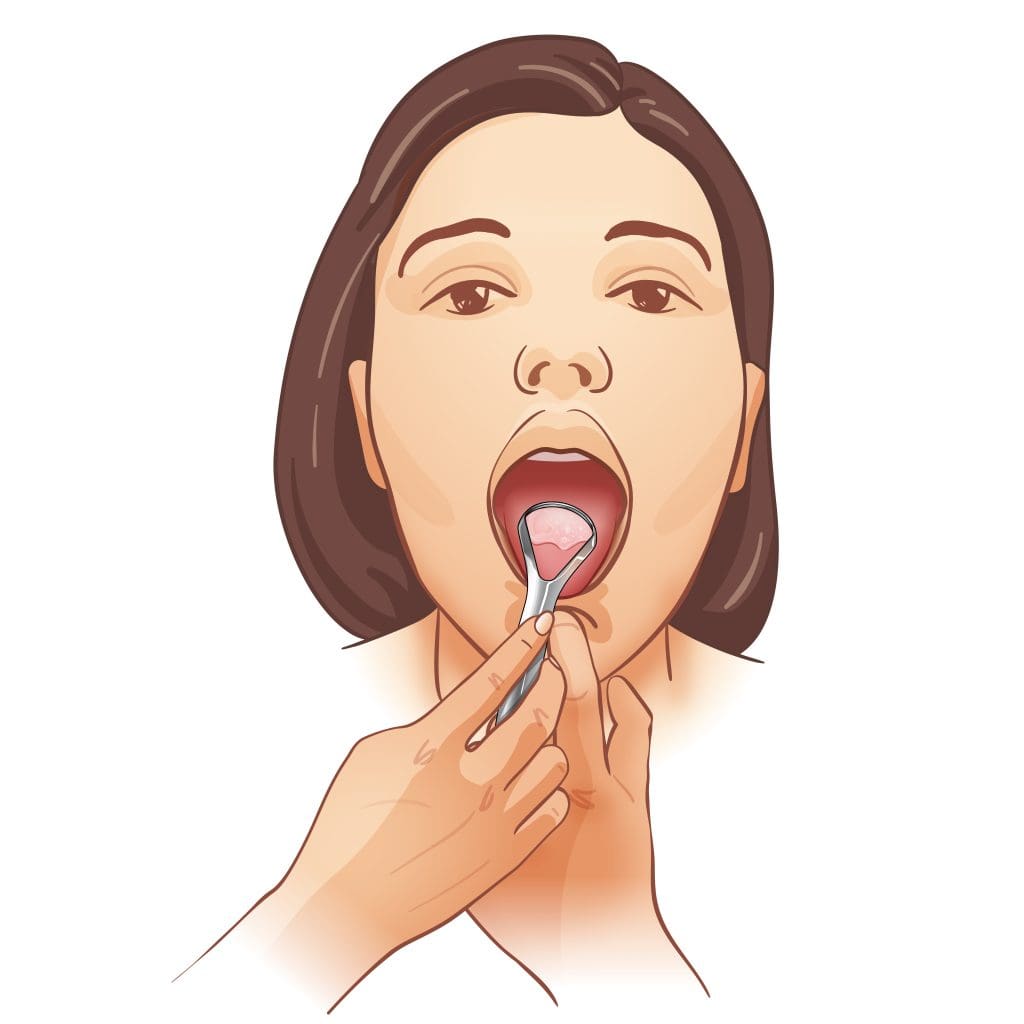 06-Tongue-Scraper-I-04-Gag-Effect-Chin pressing the chin to avoid gag reflex