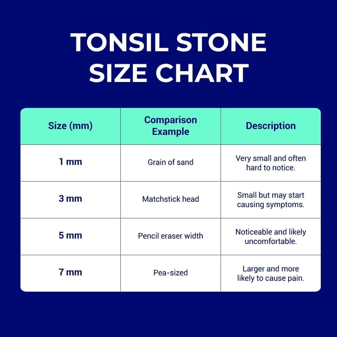 ORAVIX-Tonsil-Stone-Size-Chart-EN-Final tonsil stone size chart, from 1 to 7 mm.